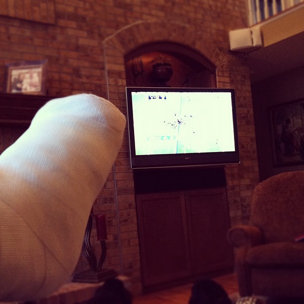 Laid up, watching some #BRONCOS football. #healheel #snapsofmyfoot