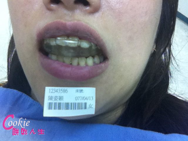 牙齒 01 (10)