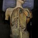 Museo Anatomía cadáver