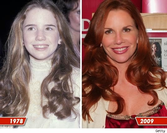 Melissa Gilbert Plastic Surgery Before and After Nose Job, Botox Injections Pictures