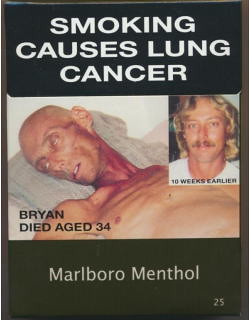 （肺癌、COPD）これは殆どの喫煙者がな...