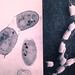 Coccidioides spores