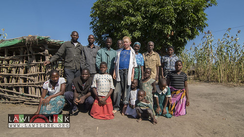 Persons with Albinism • <a style="font-size:0.8em;" href="http://www.flickr.com/photos/132148455@N06/27145656622/" target="_blank">View on Flickr</a>