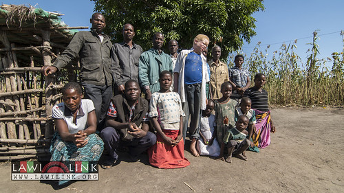 Persons with Albinism • <a style="font-size:0.8em;" href="http://www.flickr.com/photos/132148455@N06/27208494816/" target="_blank">View on Flickr</a>
