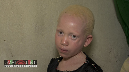 Persons with Albinism • <a style="font-size:0.8em;" href="http://www.flickr.com/photos/132148455@N06/26637078494/" target="_blank">View on Flickr</a>