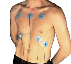 ECG male chest