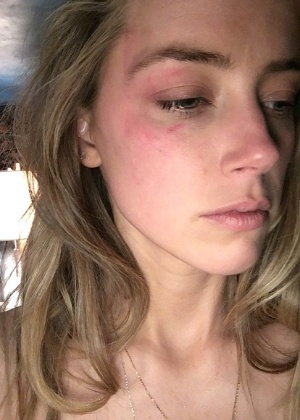 Policiais afirmam não terem visto sinais de agressão em mulher de Depp