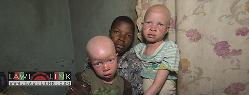 Persons with Albinism • <a style="font-size:0.8em;" href="http://www.flickr.com/photos/132148455@N06/27173630021/" target="_blank">View on Flickr</a>