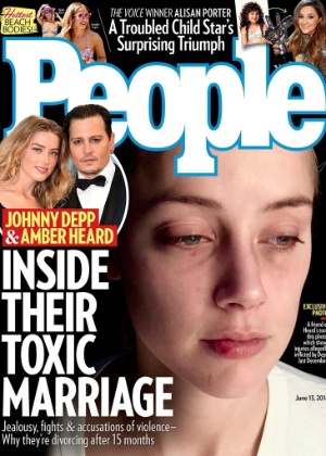 Revista divulga novas fotos de Amber Heard com o rosto machucado