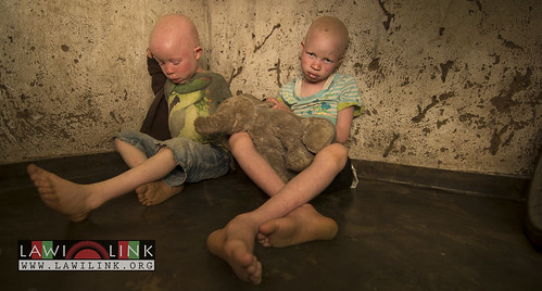 Persons with Albinism • <a style="font-size:0.8em;" href="http://www.flickr.com/photos/132148455@N06/26967541640/" target="_blank">View on Flickr</a>