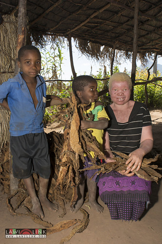 Persons with Albinism • <a style="font-size:0.8em;" href="http://www.flickr.com/photos/132148455@N06/27145862502/" target="_blank">View on Flickr</a>