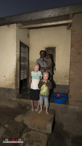 Persons with Albinism • <a style="font-size:0.8em;" href="http://www.flickr.com/photos/132148455@N06/26635942194/" target="_blank">View on Flickr</a>