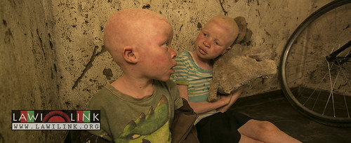 Persons with Albinism • <a style="font-size:0.8em;" href="http://www.flickr.com/photos/132148455@N06/26637236293/" target="_blank">View on Flickr</a>