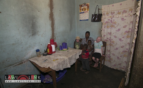 Persons with Albinism • <a style="font-size:0.8em;" href="http://www.flickr.com/photos/132148455@N06/26635879584/" target="_blank">View on Flickr</a>