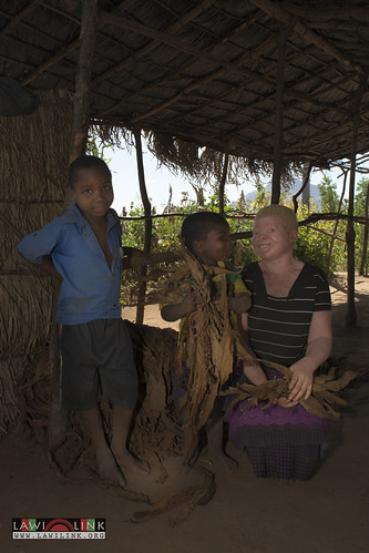 Persons with Albinism • <a style="font-size:0.8em;" href="http://www.flickr.com/photos/132148455@N06/27145853592/" target="_blank">View on Flickr</a>