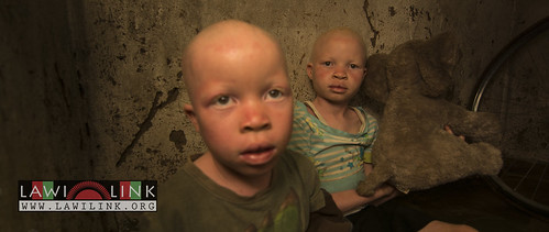 Persons with Albinism • <a style="font-size:0.8em;" href="http://www.flickr.com/photos/132148455@N06/26637244913/" target="_blank">View on Flickr</a>