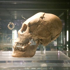Elongated Inca skull