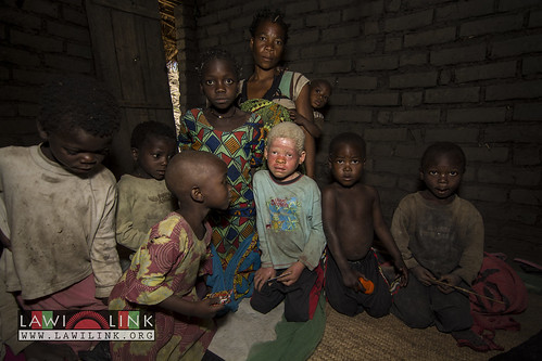 Persons with Albinism • <a style="font-size:0.8em;" href="http://www.flickr.com/photos/132148455@N06/27174117471/" target="_blank">View on Flickr</a>