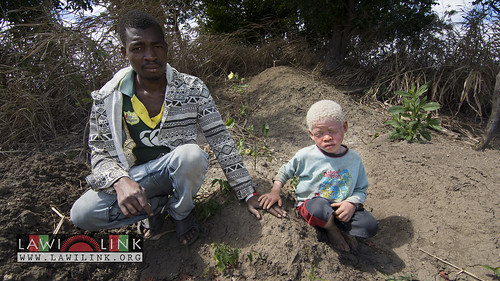 Persons with Albinism • <a style="font-size:0.8em;" href="http://www.flickr.com/photos/132148455@N06/27208899766/" target="_blank">View on Flickr</a>