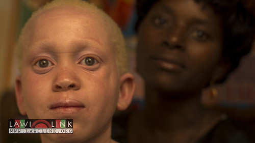 Persons with Albinism • <a style="font-size:0.8em;" href="http://www.flickr.com/photos/132148455@N06/26637032374/" target="_blank">View on Flickr</a>